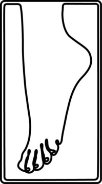 line drawing of a prosthetic foot