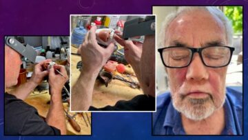 photo of the sculptiong an fitting of a wax prototype for nasal prosthesis