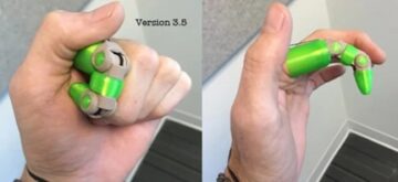 home made prosthetic finger