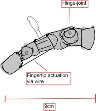hinging joints prosthesis finger