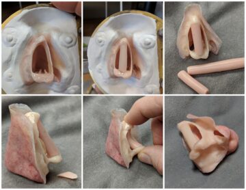 series of photos showing nasal prosthesis fabrication