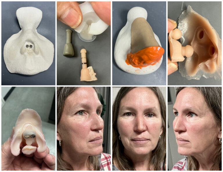 maxillofacial laboratory steps and lady wearing successful nasal prosthesis